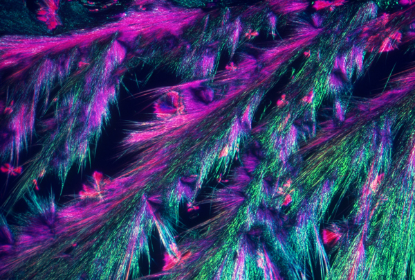 microscopic image of amino acid crystal