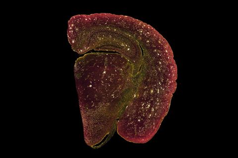 image of inflammatory responses in the cortex of the new model mouse