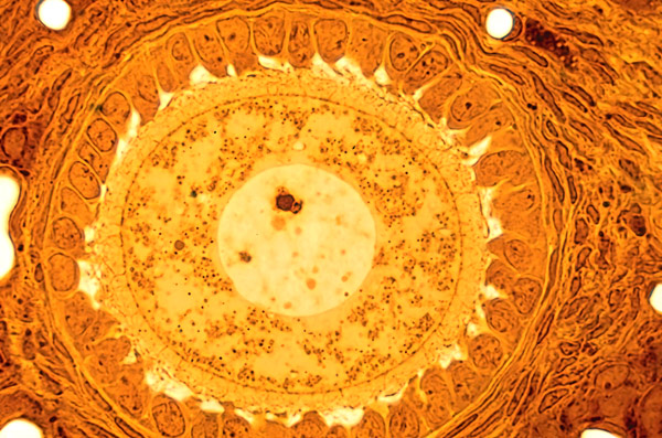 image of a large oocyte in an ovary