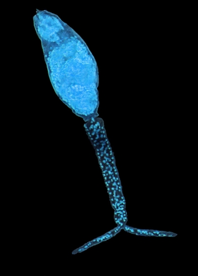 image of the larva of the parasitic flatworm that causes the disease schistosomiasis in people