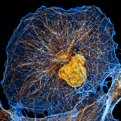 image of a cell showing the actin cytoskeleton