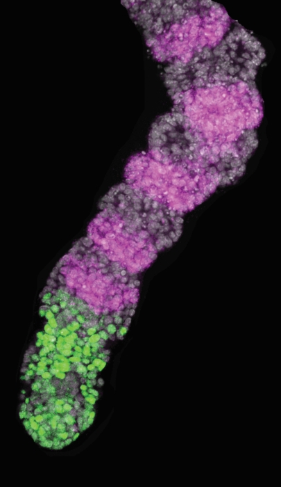a fluorescence image of an iPSM tissue model