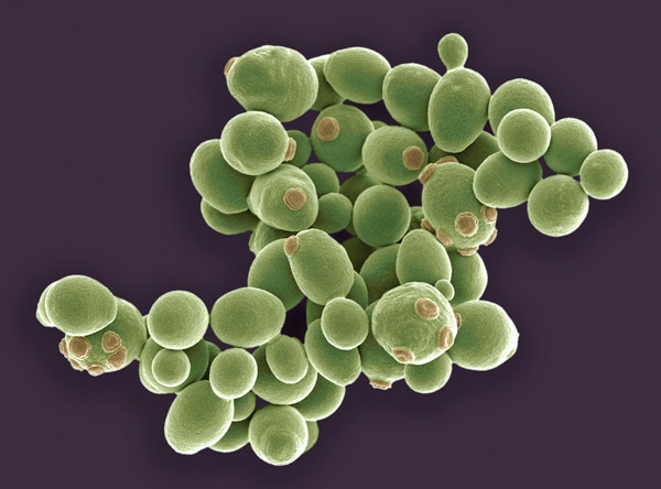 image of yeast cells
