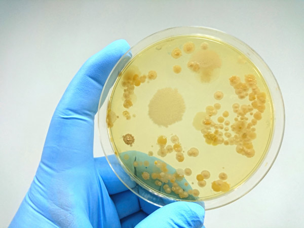 image of bacterial colonies on a culture medium