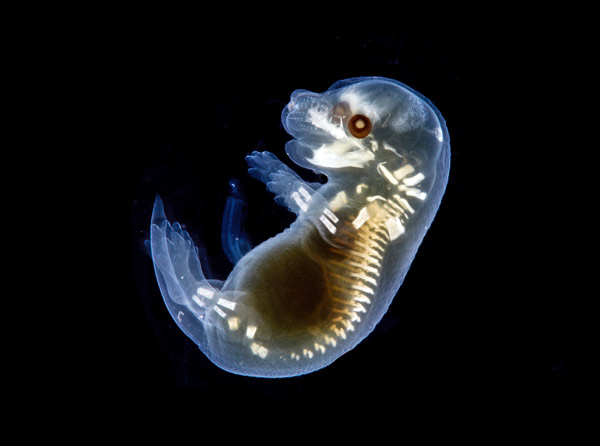 image of a mouse embryo