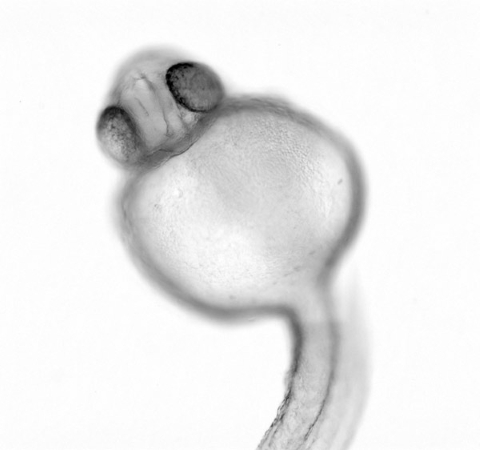 image of a zebrafish embryo